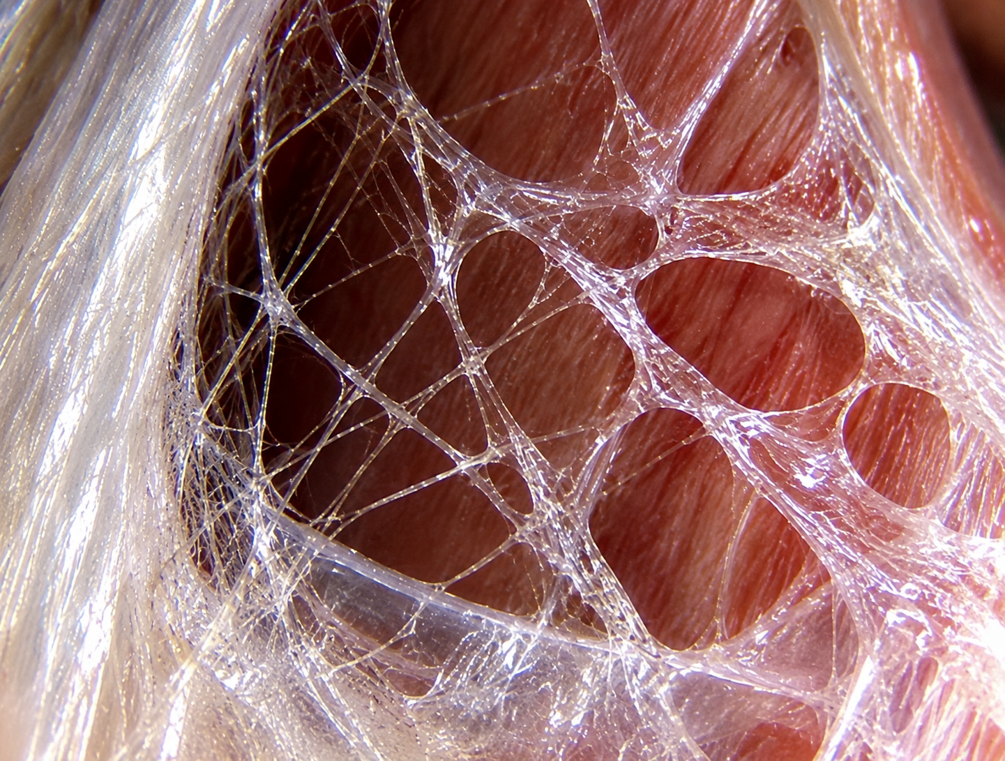 Fascia Integratie Therapie